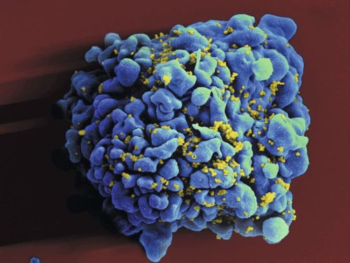 The picture shows a scanning electromicrograph of an HIV-infected human H9 T-cell. Image: NIAID-NIH