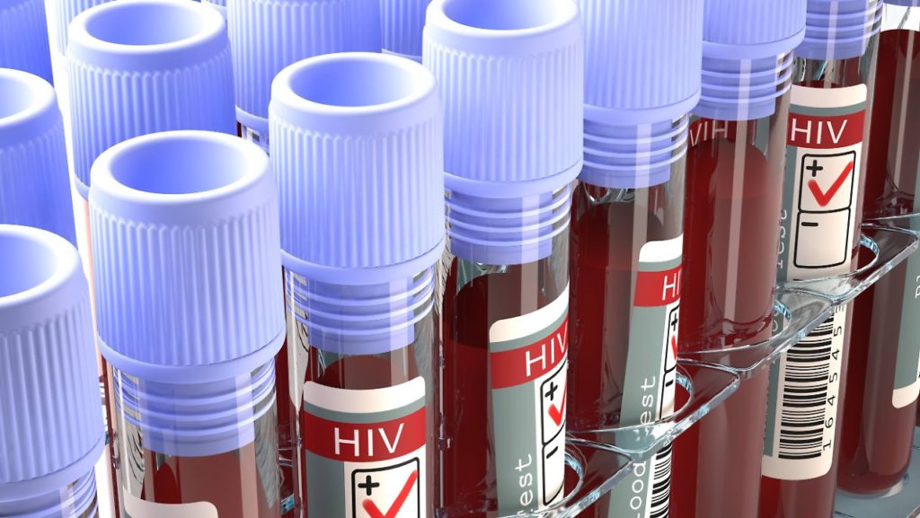 Лечение ВИЧ-пациентов в Латвии в этом году начинают раньше 2