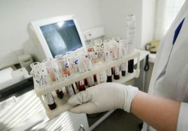 Лекарств от ВИЧ не хватает в 20 регионах РФ