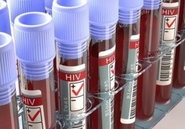 Приангарье (РФ) получит 57 млн рублей на профилактику и лечение ВИЧ-инфекции