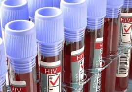 Латвия стала “печальным лидером” Евросоюза по числу новых ВИЧ-больных