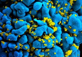 Preliminary study hints that genetically modified T cells might fight HIV