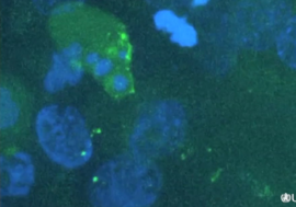 Заражение клетки вирусом иммунодефицита засняли на видеомикроскоп